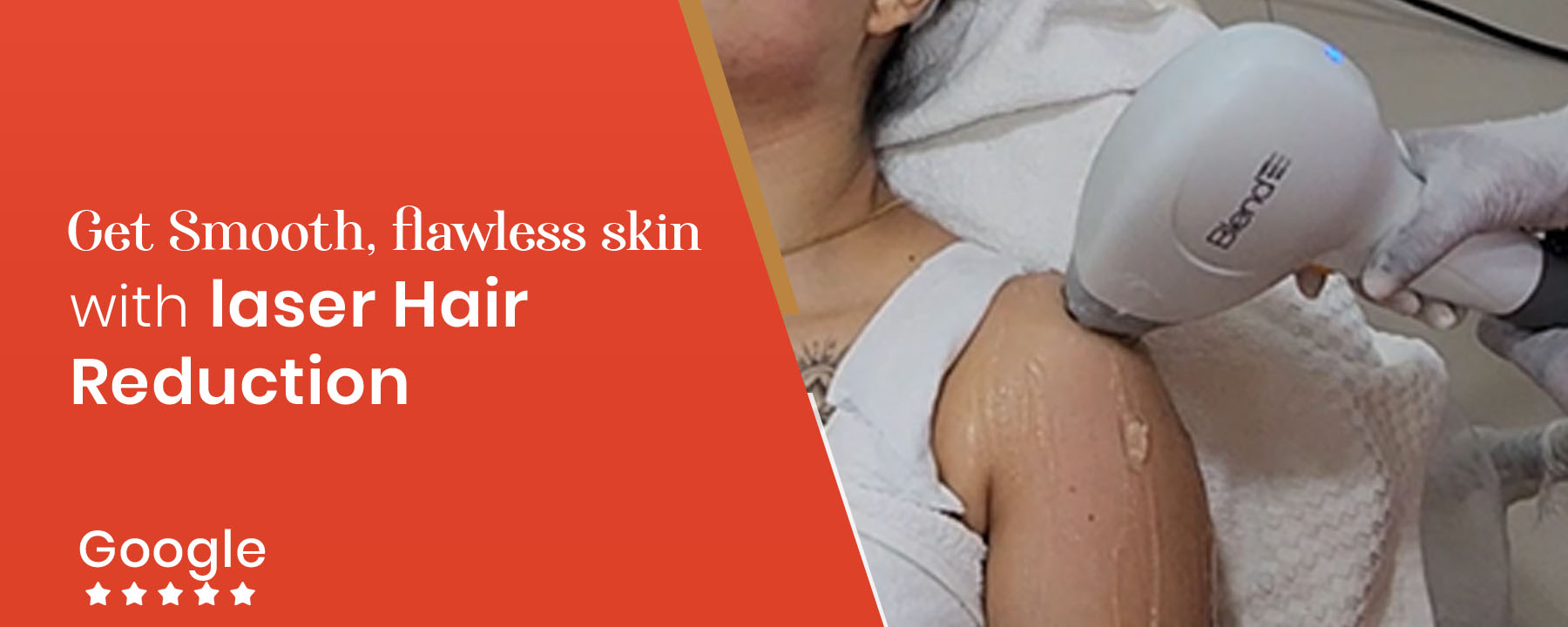 laser hair reduction_