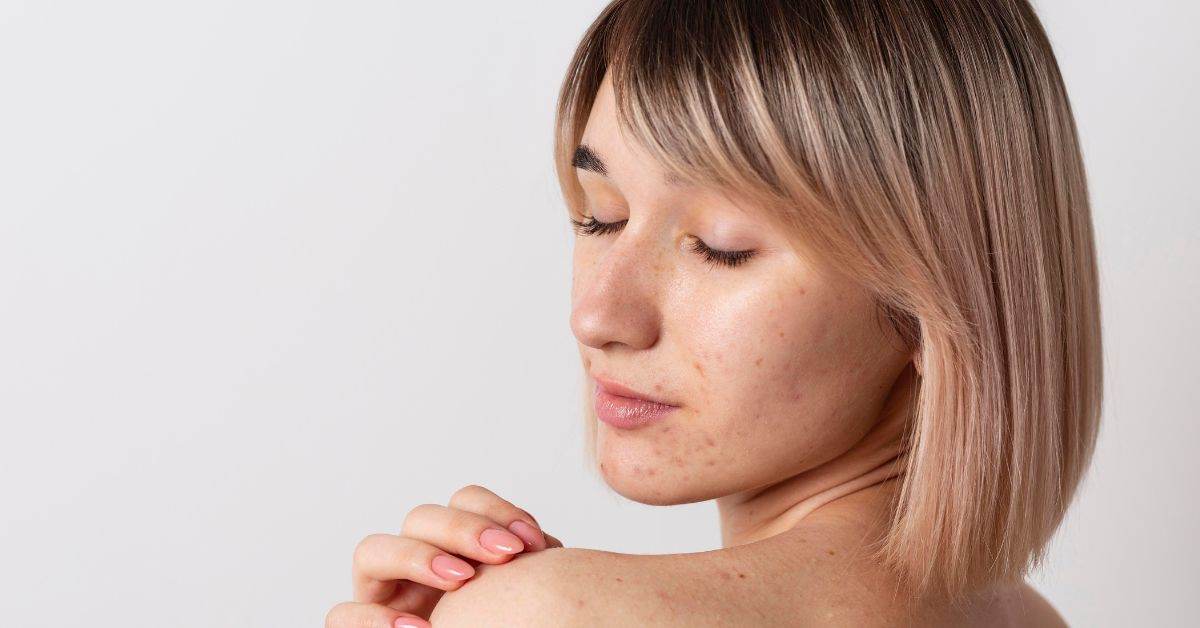 Dermatology Clinic in Kandivali