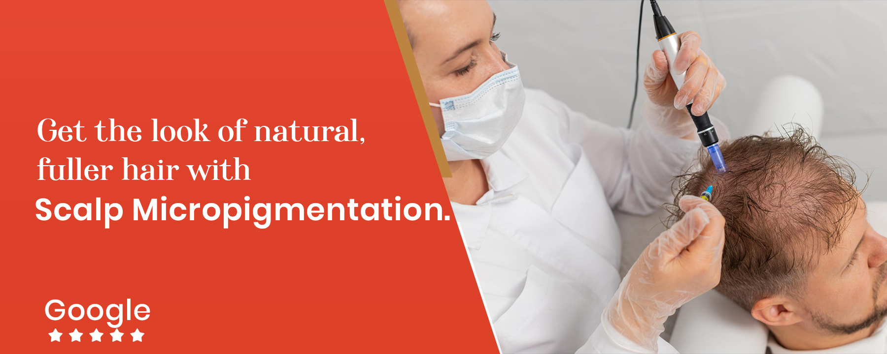 Best Hair Fall Treatment in Kandivali Mumbai | Best Scalp Micropigmentation Treatment