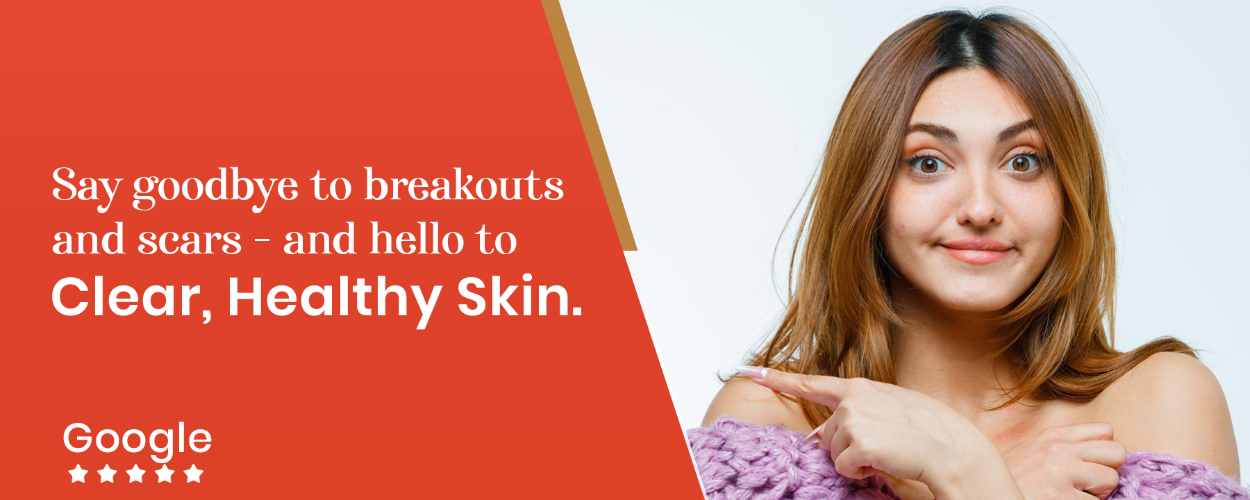 Best Acne & Acne Scars Treatment in Kandivali Mumbai | Beautera Hair & Skin Clinic