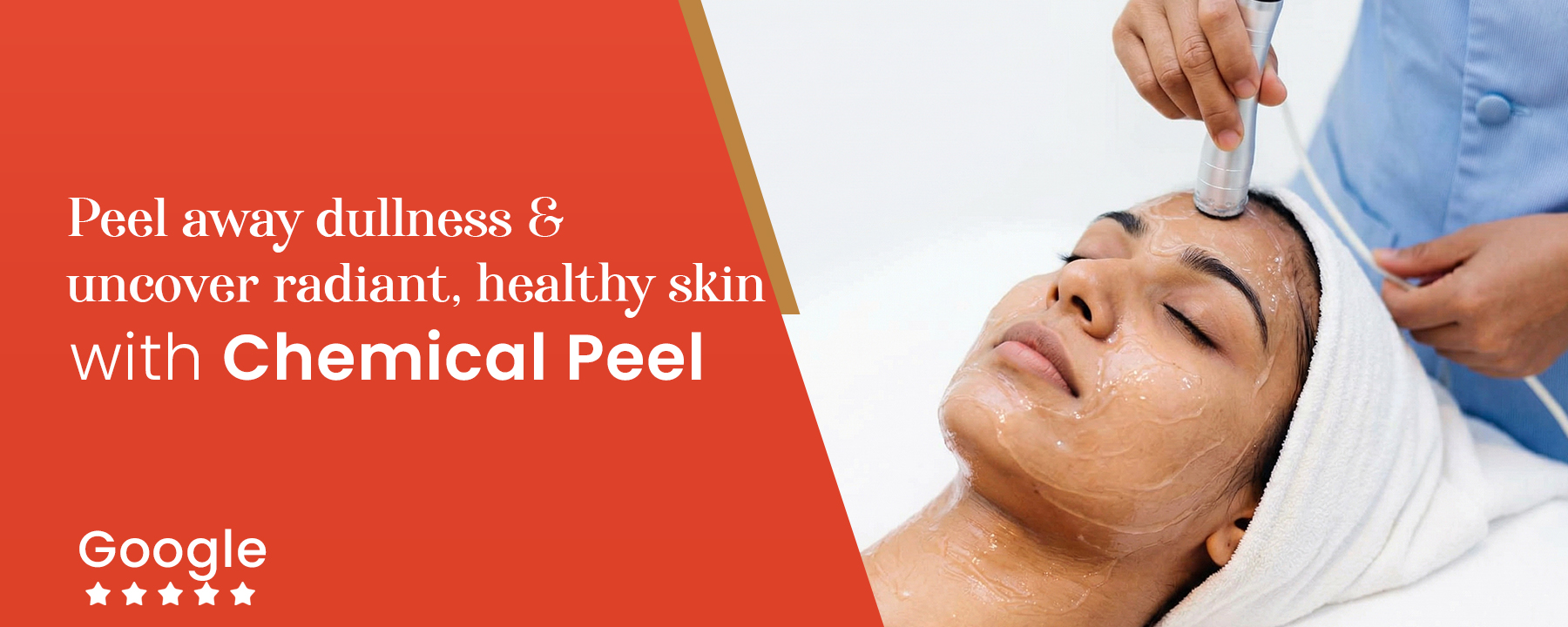 Best Chemical Peel in Kandivali.jpg