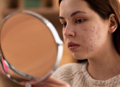 best skin clinic in Kandivali, Mumbai,