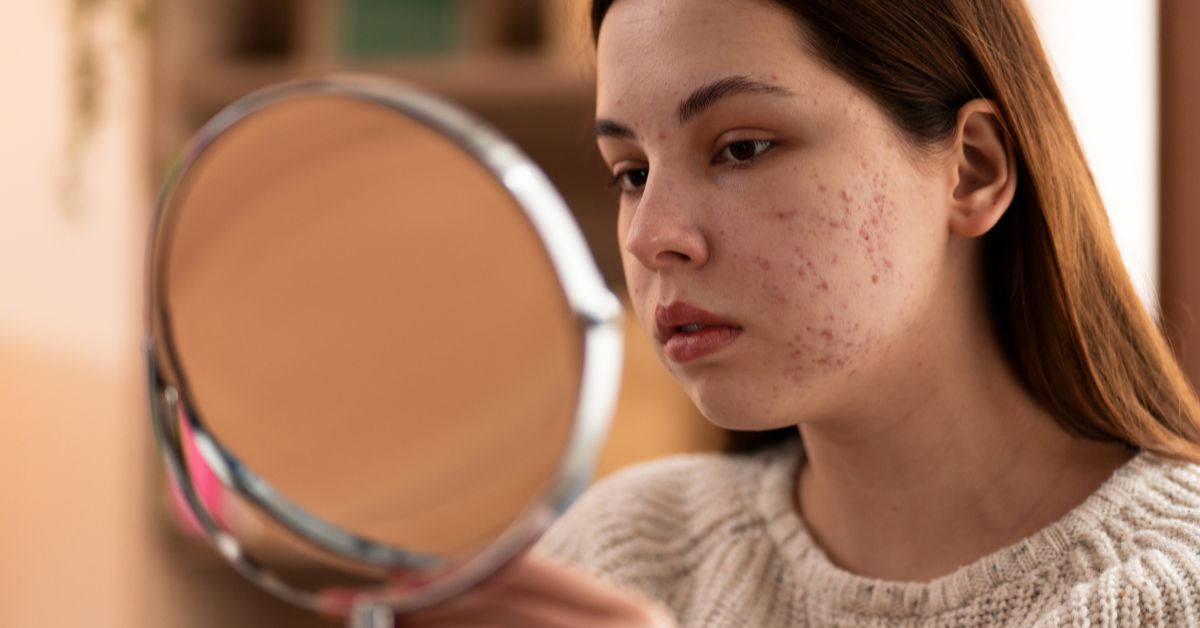 best skin clinic in Kandivali, Mumbai,