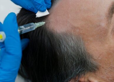 hair mesotherapy treatment in Kandivali