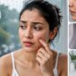 best skin clinic near me in Kandivali 85x85